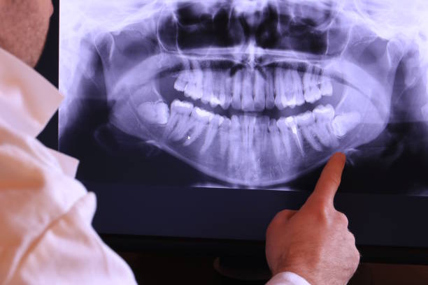 Best Emergency Cosmetic Dentistry in Aurora, IL