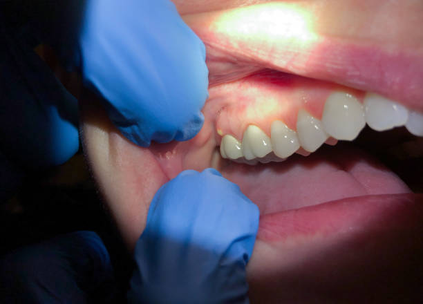 Best Mobile Emergency Dentist in Aurora, IL